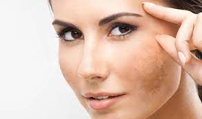 Beauty Routine Anti Macchie